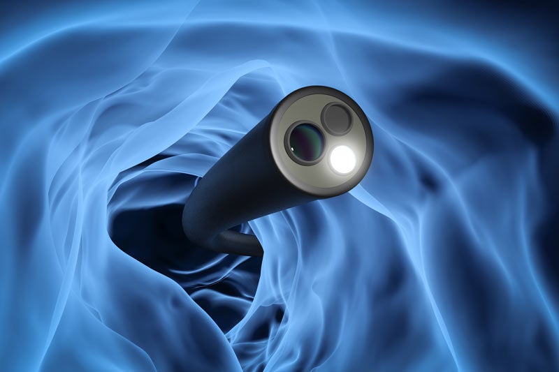 Rendering of colonoscopy camera
